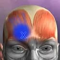 Muscle Trigger Point Anatomy